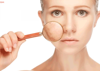 En İyi Sivilce Kremleri