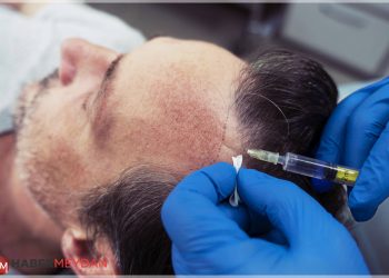 1 Milyon Kişi, Saç Ektirmek İçin Türkiye’yi Seçti!