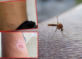 İstanbul’da sivrisinek endişesi artıyor!