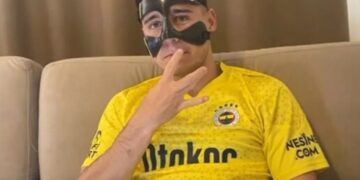 Emre Mor burnunu yaptırdı!