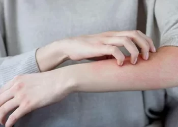 Uyuz Hastalığı Nedir? Uyuz Belirtileri Nelerdir?