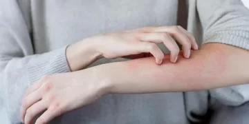 Uyuz Hastalığı Nedir? Uyuz Belirtileri Nelerdir?