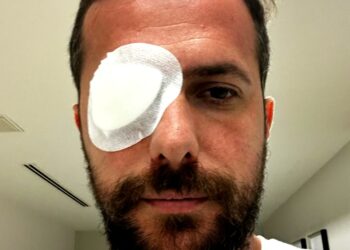 Eyüpspor kaptanı Uğur Demirok’un retinası yırtıldı!