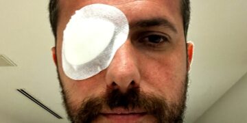 Eyüpspor kaptanı Uğur Demirok’un retinası yırtıldı!