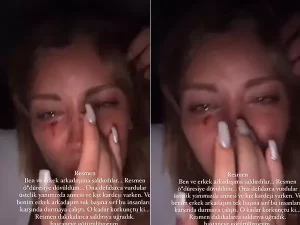 mika raun habermeydan