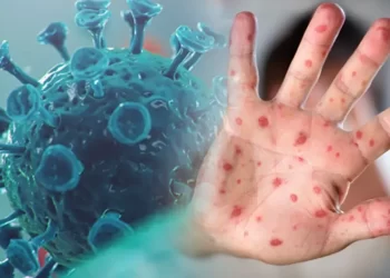 50 yaş üstü için ‘Maymun çiçeği’ uyarısı