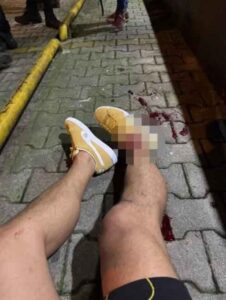 Serhat Akın silahlı saldırıya uğradı! Serhat Akin silahli saldiriya ugradi1 habermeydan