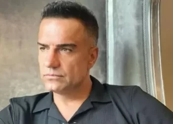 Ünlü türkücüden çok konuşulan estetik itirafı! Bakın Berdan Mardini yüzüne ne yaptırıyormuş!