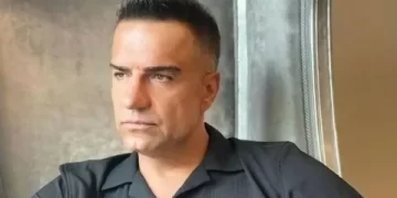 Ünlü türkücüden çok konuşulan estetik itirafı! Bakın Berdan Mardini yüzüne ne yaptırıyormuş!