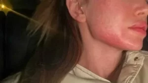 Danla Bilic'ten yeni açıklama! Sosyal medyada şiddeti küçümseyenlere sert tepki verdi: "Vurdu, gitti demek kolay mı?" danla bilic darp habermeydan