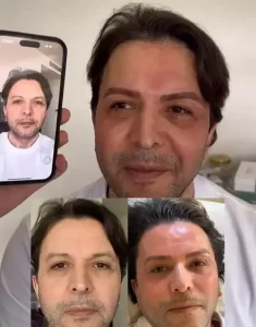 nihat dogan estetik1 habermeydan