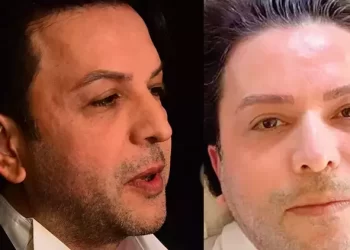 Nihat Doğan’ın Ayrılık sürecinde kaşları döküldü! ‘Sadece kaş yaptırdım’
