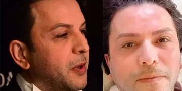 Nihat Doğan’ın Ayrılık sürecinde kaşları döküldü! ‘Sadece kaş yaptırdım’