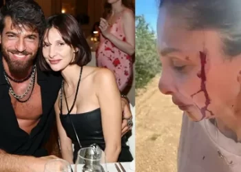 Can Yaman’ın sevgilisi DJ Sara Bluma, şiddeti paylaştı!