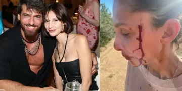 Can Yaman’ın sevgilisi DJ Sara Bluma, şiddeti paylaştı!