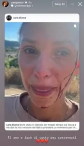 Can Yaman sevgilisi DJ Sara Bluma siddet paylasti1 habermeydan