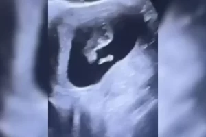 beste kokdemir dugunde bebek mujdesi2 habermeydan