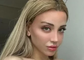 Sosyal medya fenomeni Mika Raun tatil için gittiği Dubai’de araba kazası geçirdi!