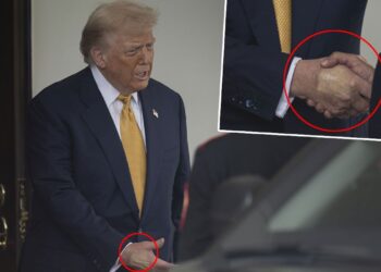 Trump’ın vücudundaki şişlik ve morluklarla ilgili Beyaz Saray’dan açıklama geldi