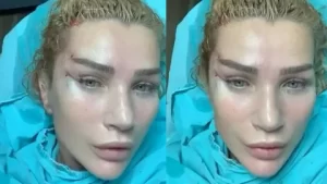 Seda Sayan estetik bagimlisi iddialarini yanitladi1 habermeydan
