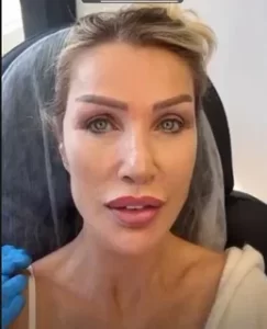 Seda Sayan estetik bagimlisi iddialarini yanitladi2 habermeydan
