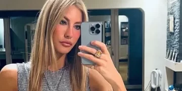 Çağla Şıkel paylaştı bacakları mosmor oldu