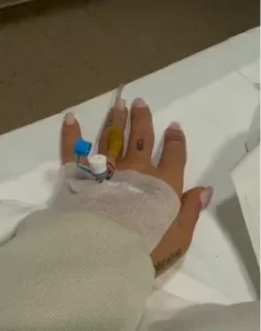 Irem Derici hastanelik oldu1 habermeydan