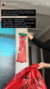 Danla Bilic 5inci kez ameliyat oldu2 habermeydan