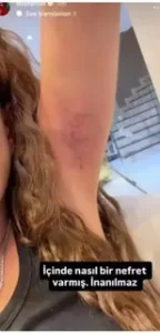 Dilan Polat kardesi Sila Dogu tarafindan darp edildigini iddia etti2 habermeydan