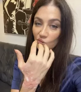 Ceren Benderlioglu elinden yaralandi1 habermeydan