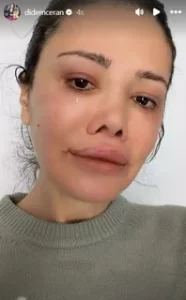 Didem Ceran kanser surecinde oldugunu acikladi1 habermeydan
