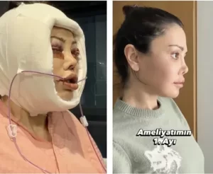 Didem Ceran kanser surecinde oldugunu acikladi2 habermeydan