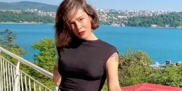 Didem Ceran yüz nakli yaptırdı!