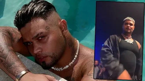 Aldığı kilolarla Rihannaya benzetilen rapçi Lvbel C5 hastalığını açıkladı Lvbel C5 hastaligini acikladi habermeydan