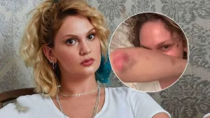 Farah Zeynep Abdullah sevenlerini endiselendirdi1 habermeydan