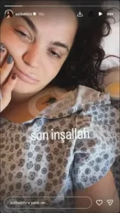 AslI Bekiroglu sekizincik kez ameliyat masasina yatacak1 habermeydan