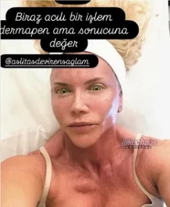 Biricik Suden estetik iddialarına isyan etti Biricik Suden estetik iddialarina isyan etti1 habermeydan