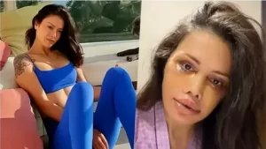 Didem Ceran yeniden operasyon geçirecek Didem Ceran yeniden operasyon gecirecek habermeydan