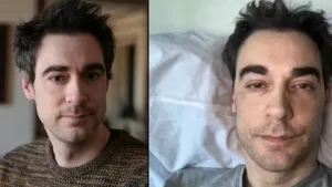Arnaud Denis’in trajik sonu: Fıtık ameliyatı sonrası ötanazi kararı Arnaud Denis trajik sonu1 habermeydan